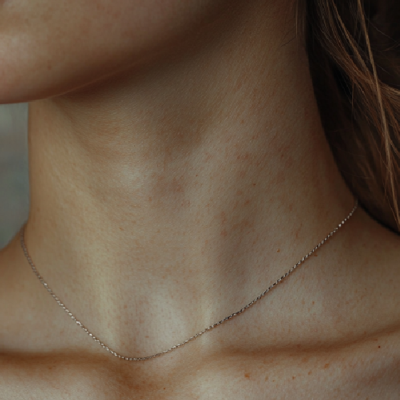 Gube v vratu: Zakaj se zgodijo in kako se jih znebiti